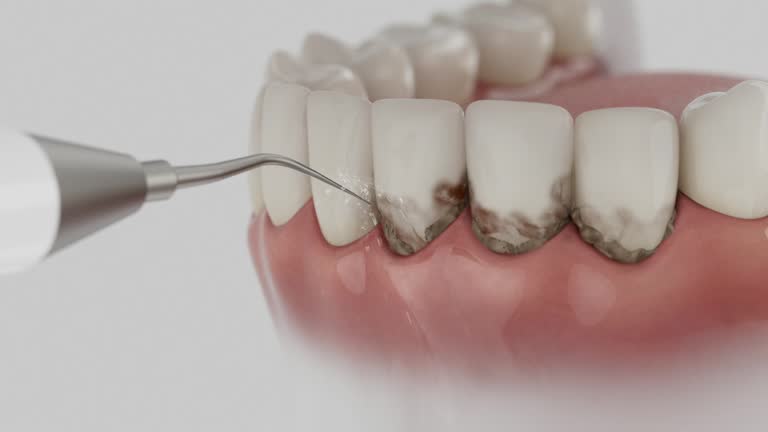 Trusted Emergency Dentist service in Gratton, VA - Dentist Open Now
